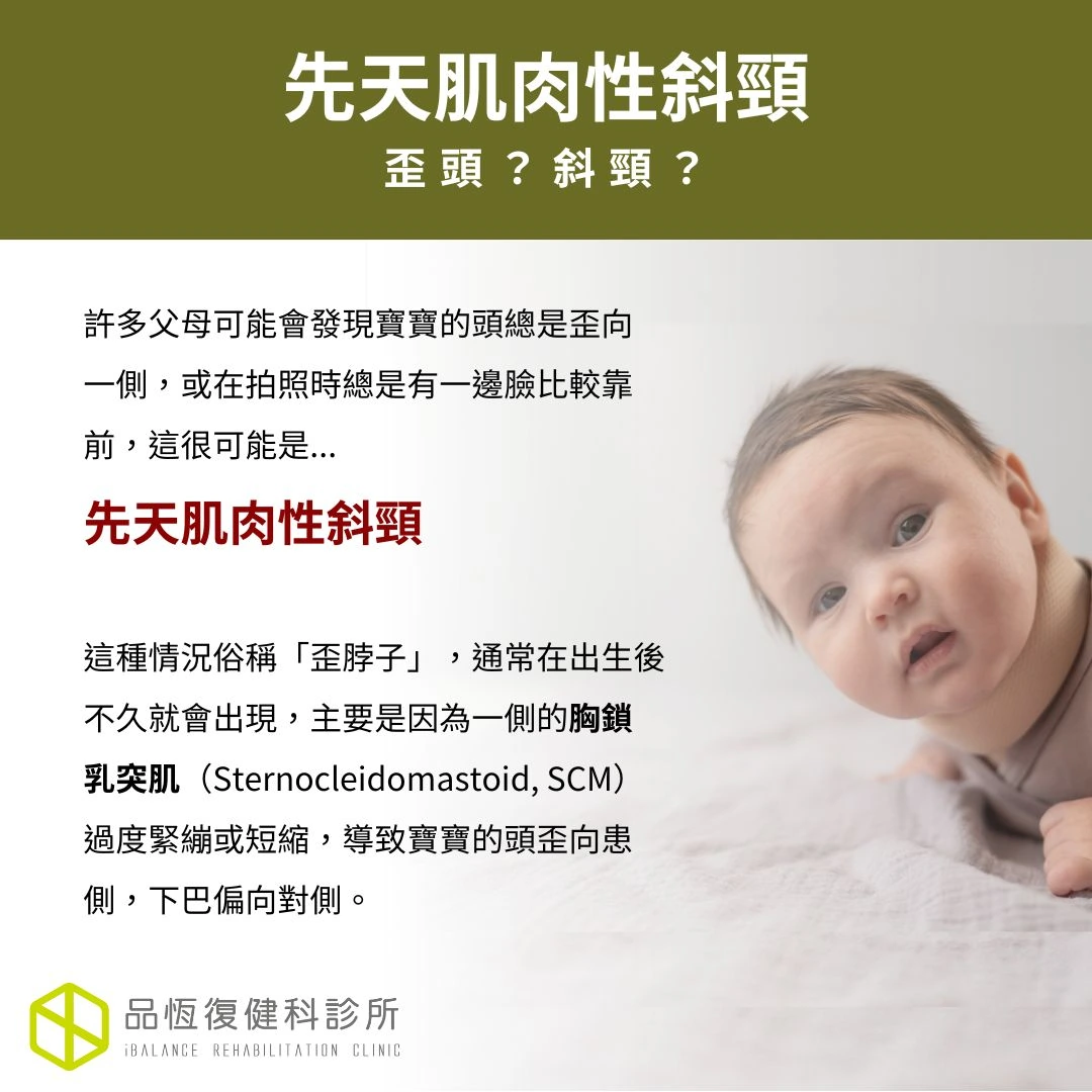 先天肌肉性斜頸 先天肌肉性斜頸