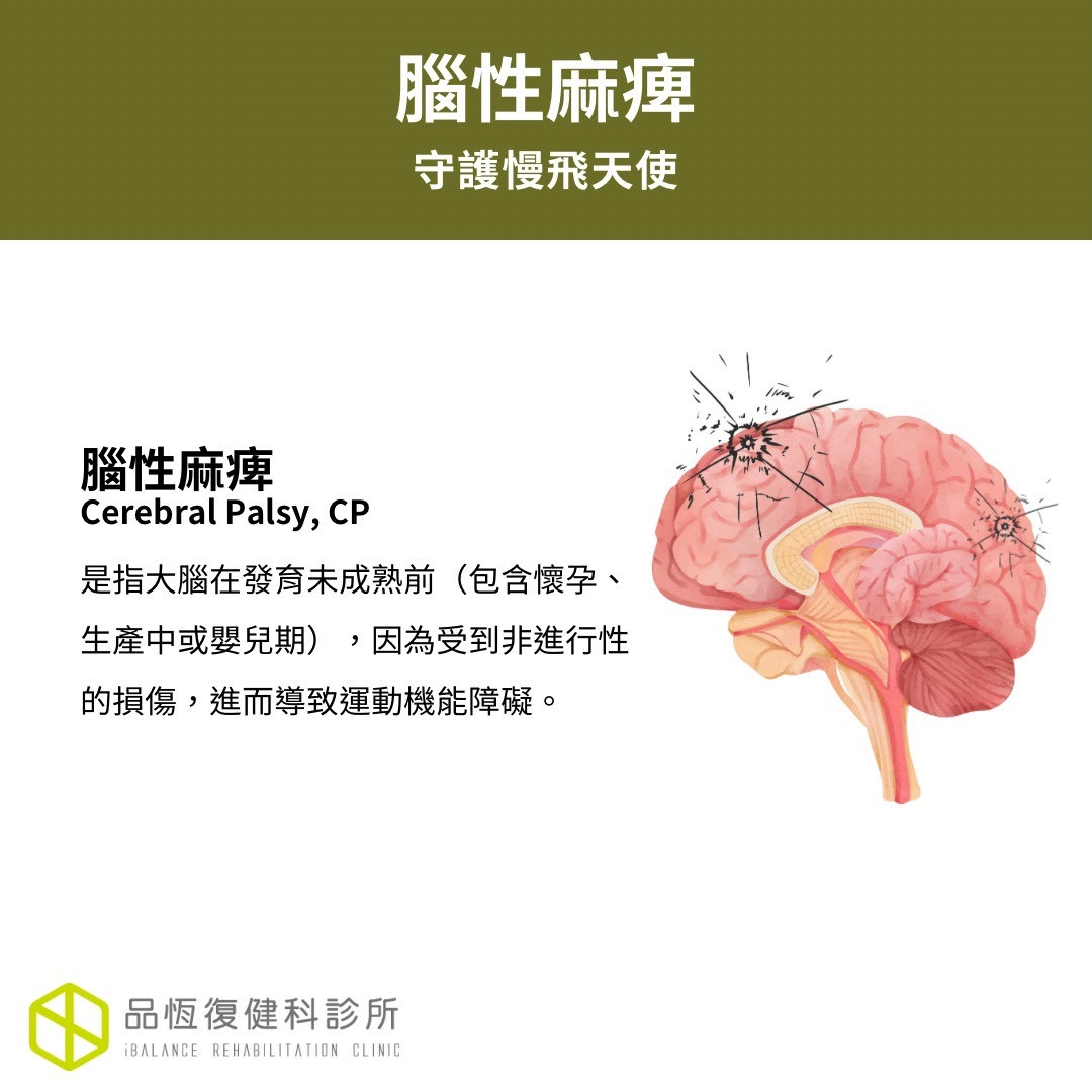 腦性麻痺