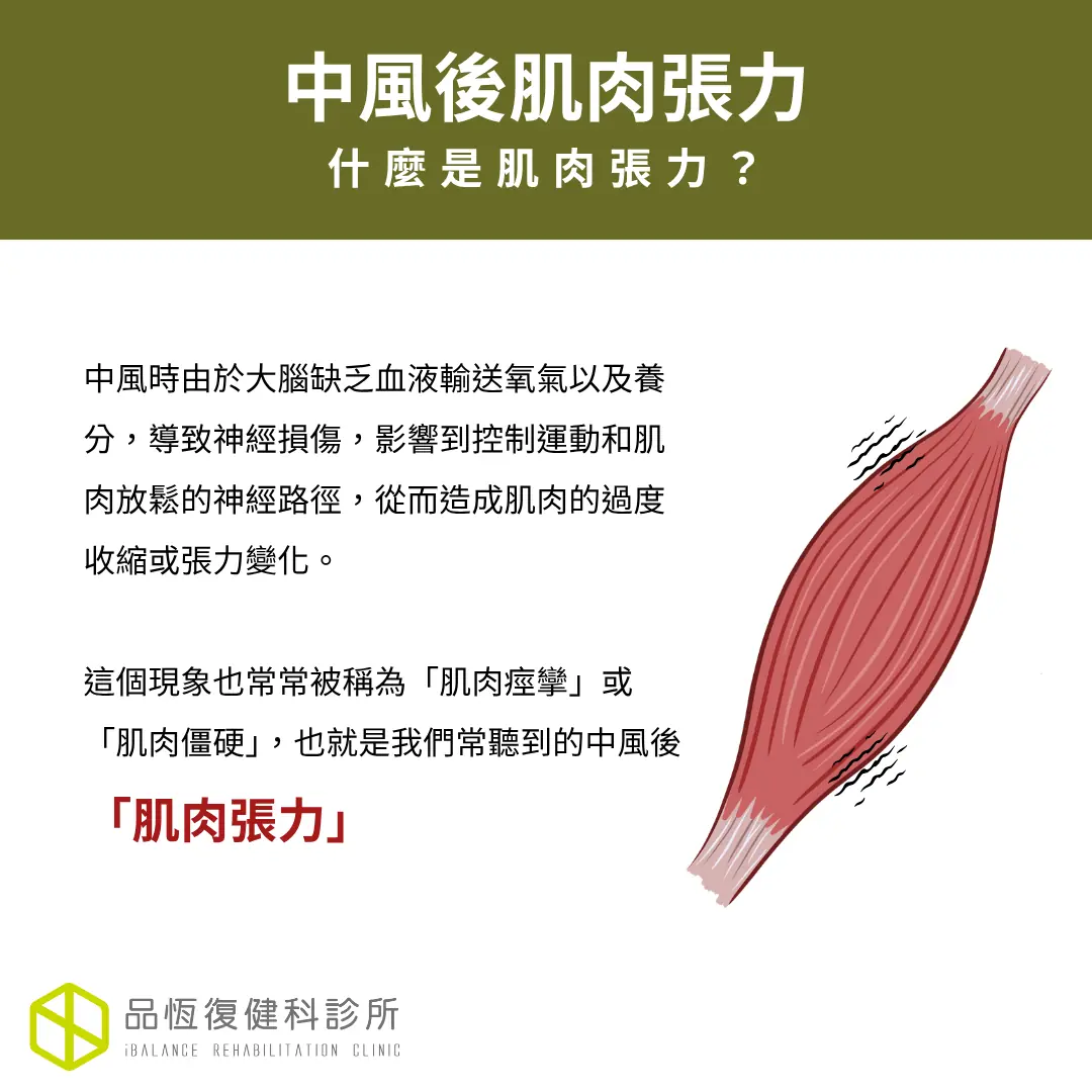 中風後肌肉張力 中風後肌肉張力