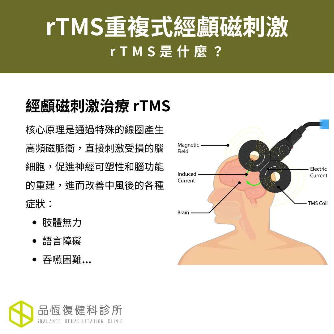 經顱磁刺激治療 經顱磁刺激治療