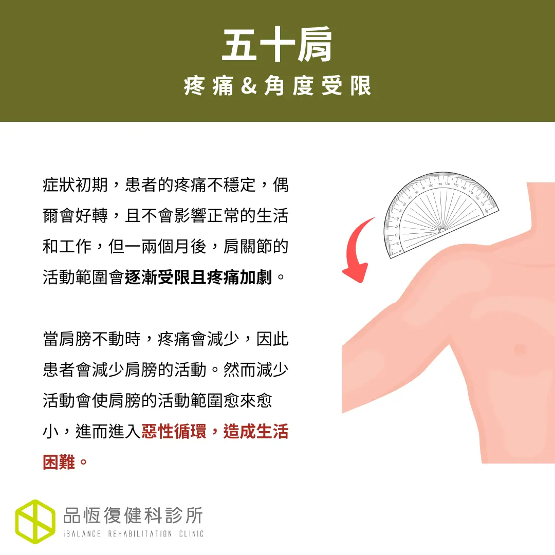 五十肩 五十肩