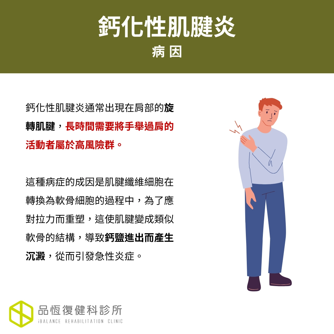 鈣化性肌腱炎 鈣化性肌腱炎