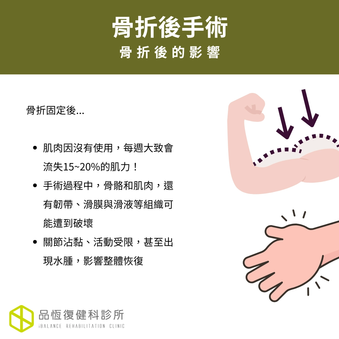 骨折後復建 骨折後復建