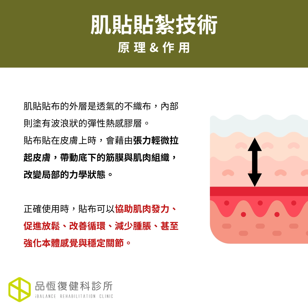肌貼貼紮技術 肌貼貼紮技術