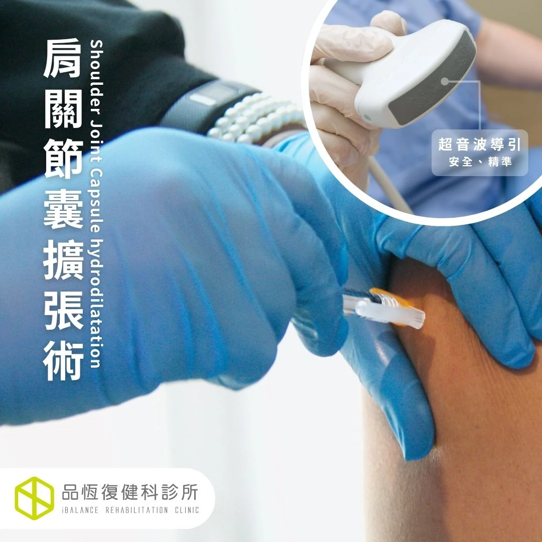 肩關節囊擴張術 肩關節囊擴張術