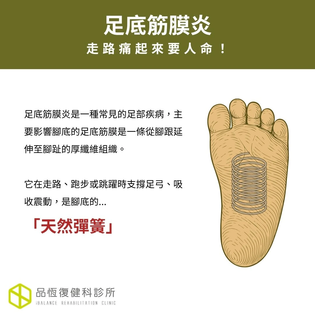 足底筋膜炎