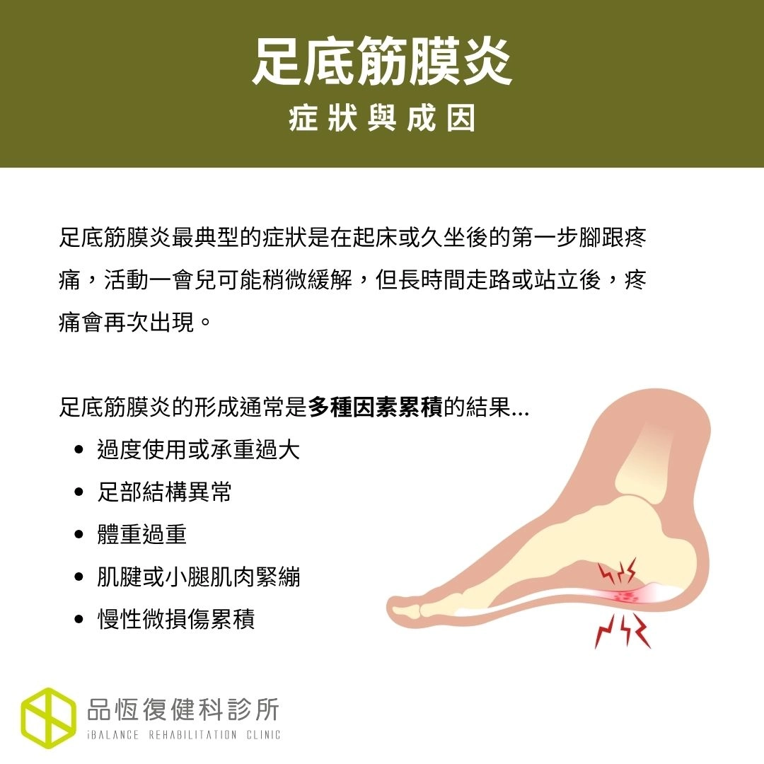 足底筋膜炎