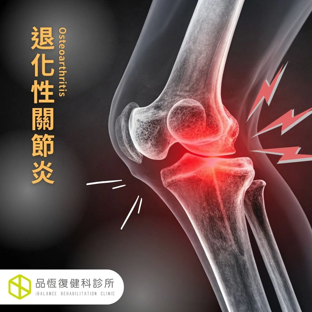 退化性關節炎