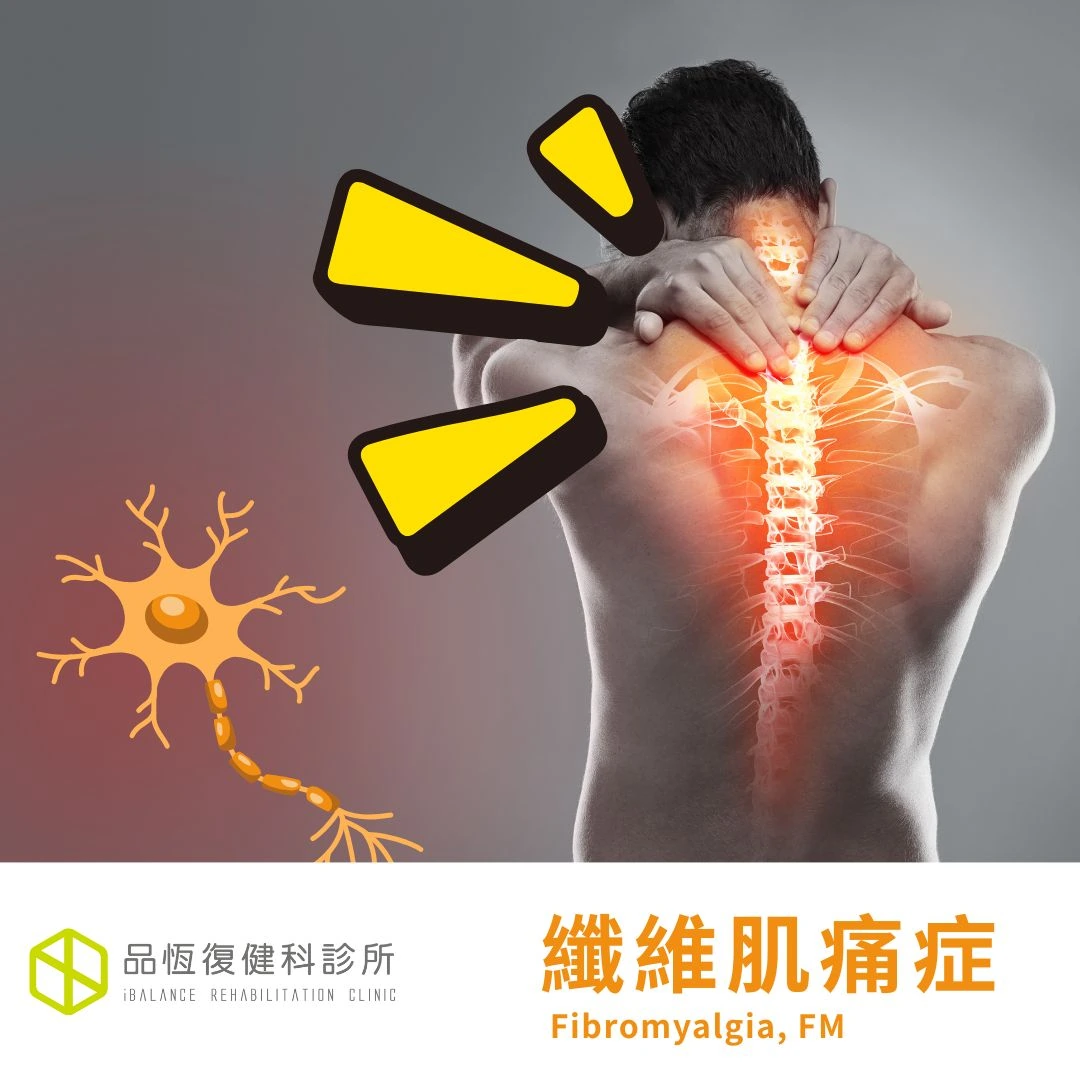 纖維肌痛症候群