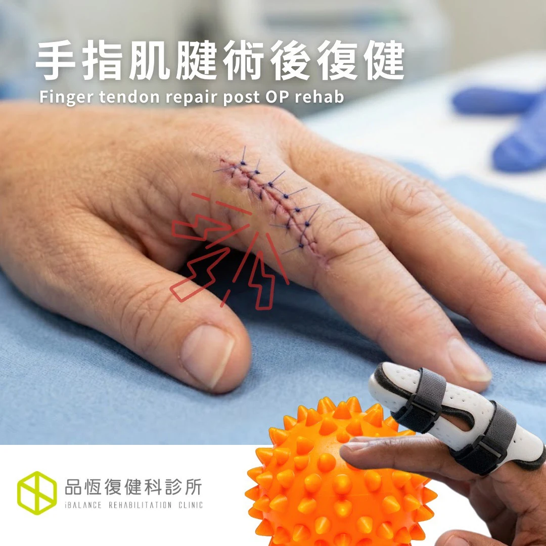 手指肌腱術後復健