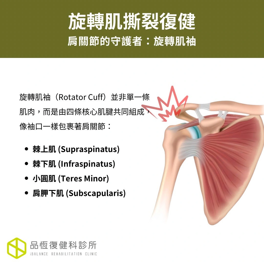 旋轉肌撕裂復健