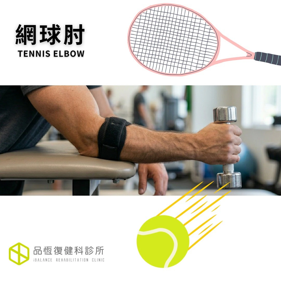 網球肘 網球肘