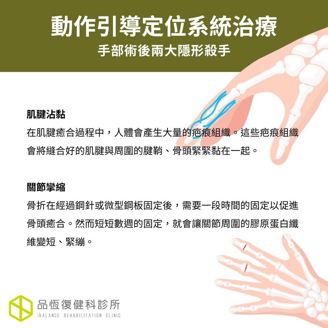 動作引導定位系統治療MAPS Therapy