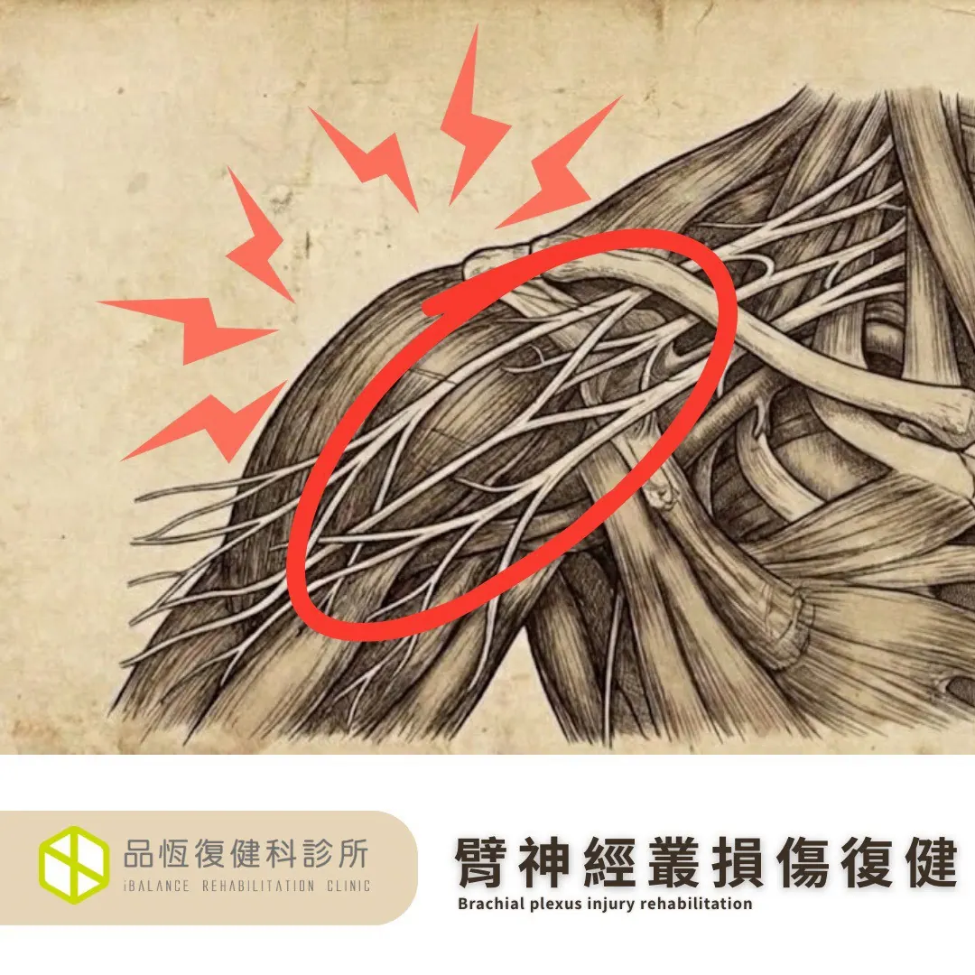 臂神經叢損傷復健
