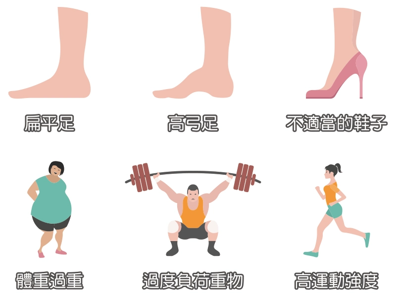 足底筋膜炎 足底筋膜炎