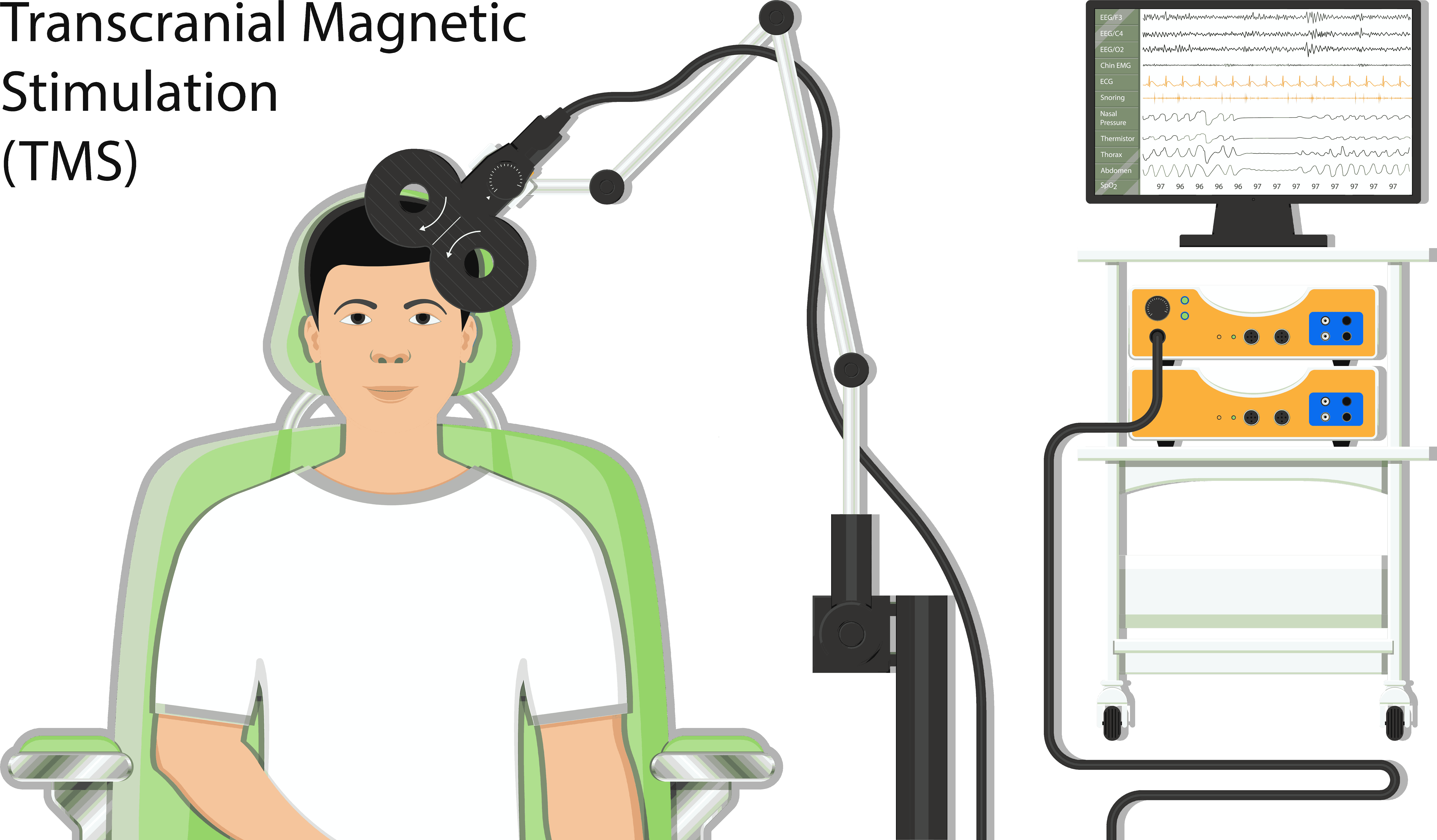 rTMS重複經顱磁刺激治療 rTMS重複經顱磁刺激治療
