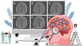 rTMS重複經顱磁刺激治療-中風後的復健新助力 rTMS重複經顱磁刺激治療-中風後的復健新助力