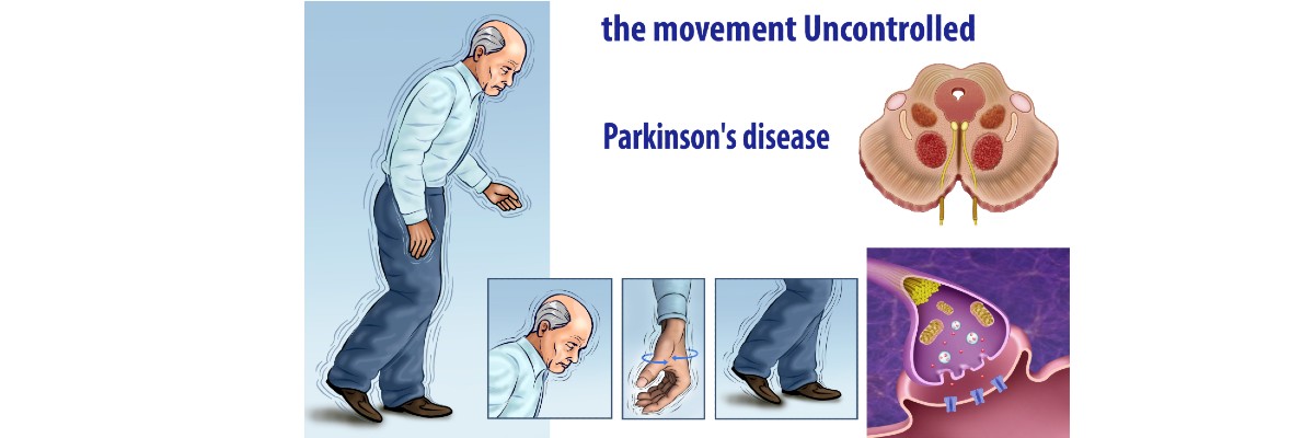 帕金森氏症（巴金森）
