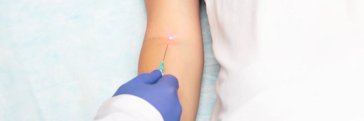 靜脈雷射治療 靜脈雷射治療