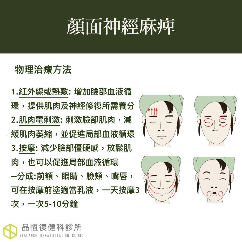 顏面神經麻痺 顏面神經麻痺